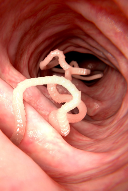 Ilustração do terreno intestinal desorganizado